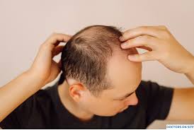 Benefits of Regular Visits to a Dermatologsit