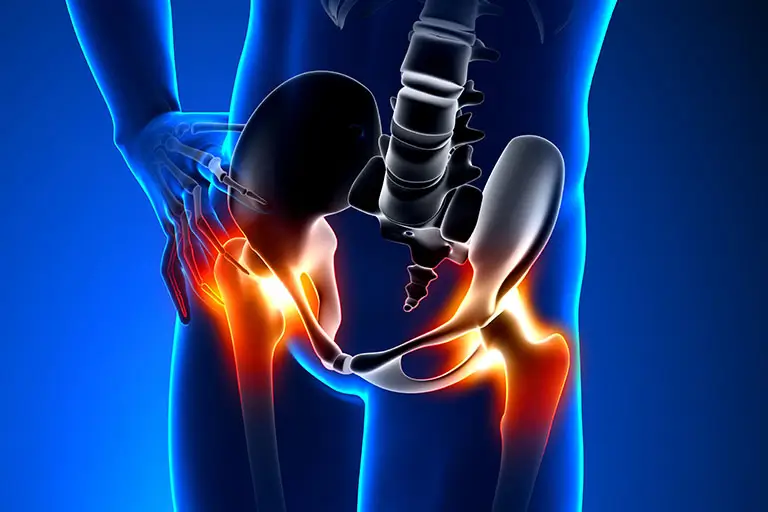 How to Differentiate Between Various Causes of Hip Pain