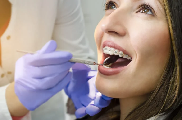 Options for Adults That Need Braces