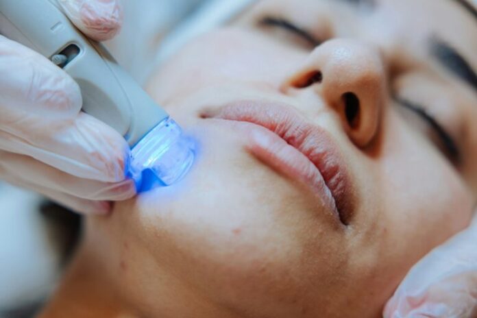 The Advantages of Laser Treatment for Skin Resurfacing