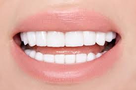 The Aesthetic Advantages of Choosing Veneers