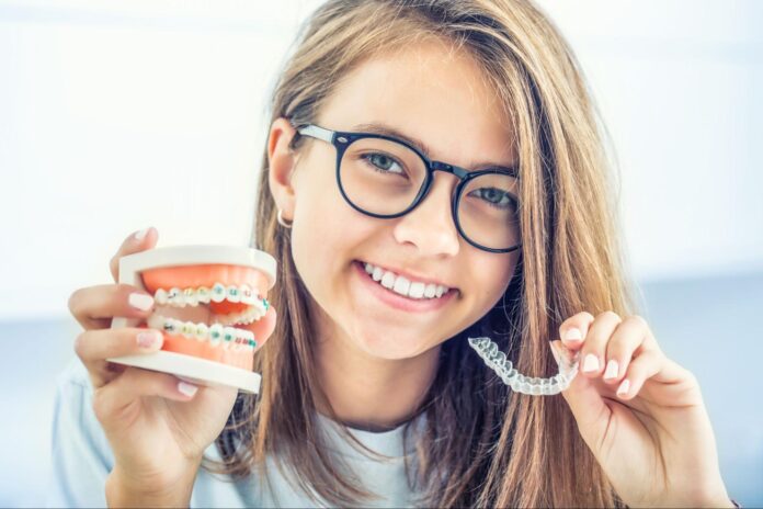 Tips for Maintaining Your Clear Aligners