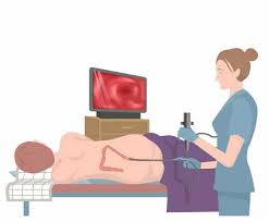 Tips for Preparing for Your First Colonoscopy