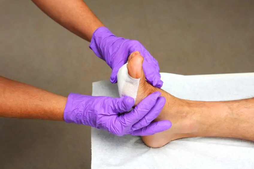 What You Need To Know About Diabetic Wound Care