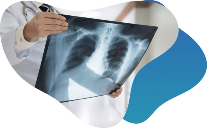 Differences between DEXA Scans and CT Scans