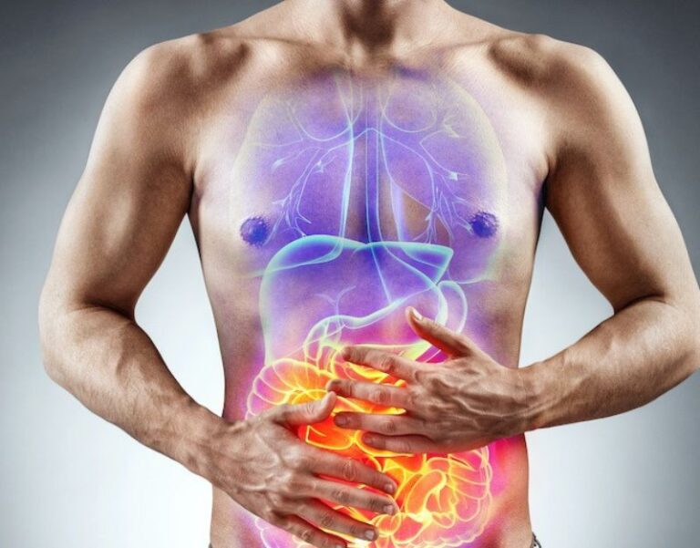 Navigating the Challenges of Crohn’s Disease