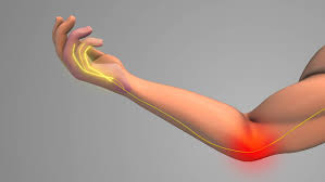 Techniques for Managing Acute Pain With Nerve Blocks