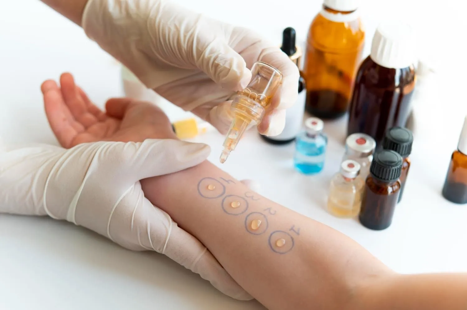 The Role of Allergy Testing in Effective Treatment Plans