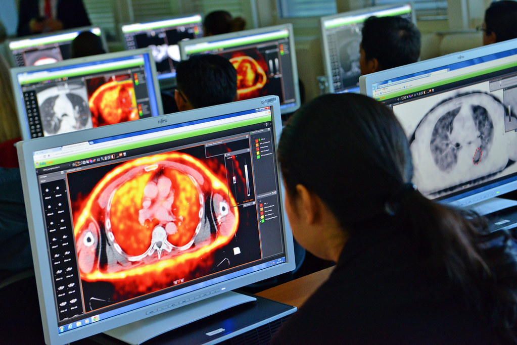 The Role of Radiation in Treating Tumors