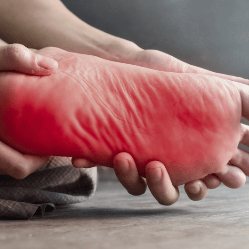 Understanding Peripheral Neuropathy Symptoms and Treatments