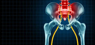 Understanding the Impact of Sciatica on Overall Quality of Life