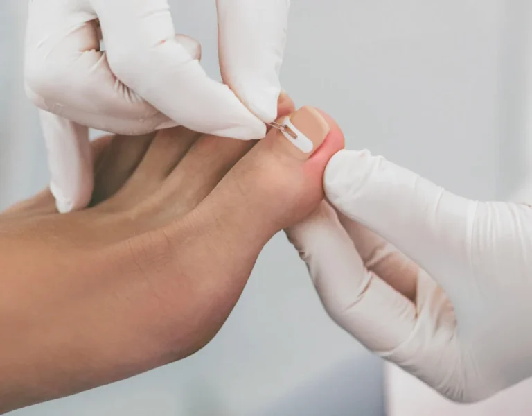 When To Visit a Podiatrist
