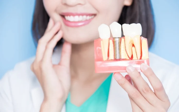Why Dental Implants Are A Permanent Solution for Missing Teeth